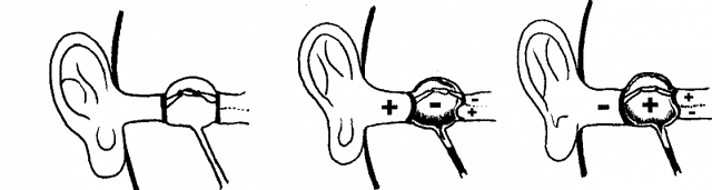 Что делать если болят уши при дайвинге